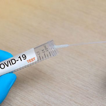 Prélèvements de dépistage Coronavirus Covid-19 (PCR et sérologie). Plateforme SI-DEP